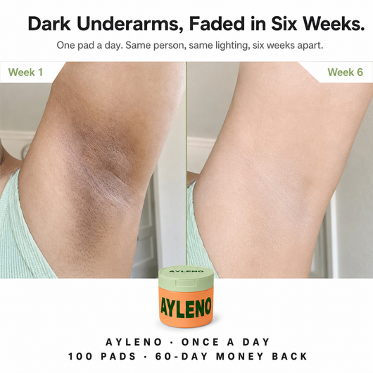 Ayleno Toner Pads for hyperpigmentation