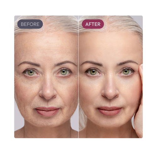 Ayleno Madeca Time Reverse Cream