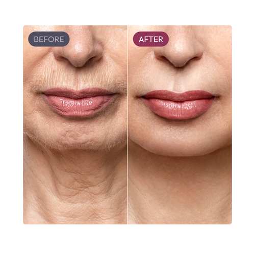 Ayleno Madeca Time Reverse Cream