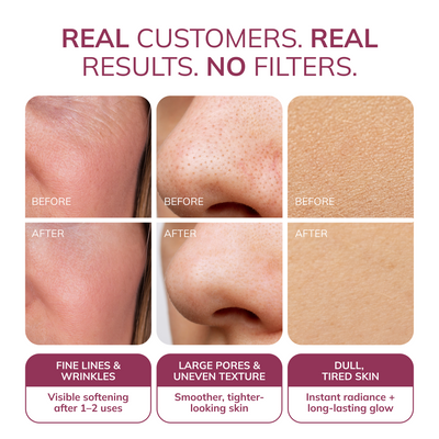 Ayleno® Snail Mucin Recovery Mask