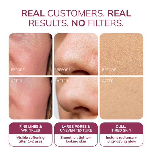 Ayleno® Snail Mucin Recovery Mask