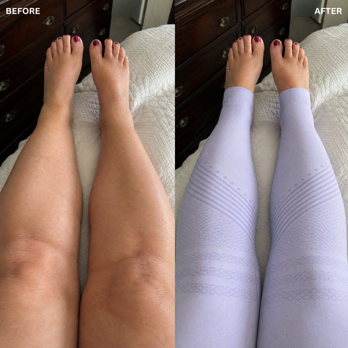 Before and after — tired legs to supported comfort